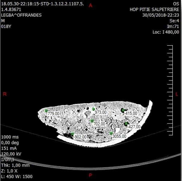 Fig2 b Scanner céramique avec densités